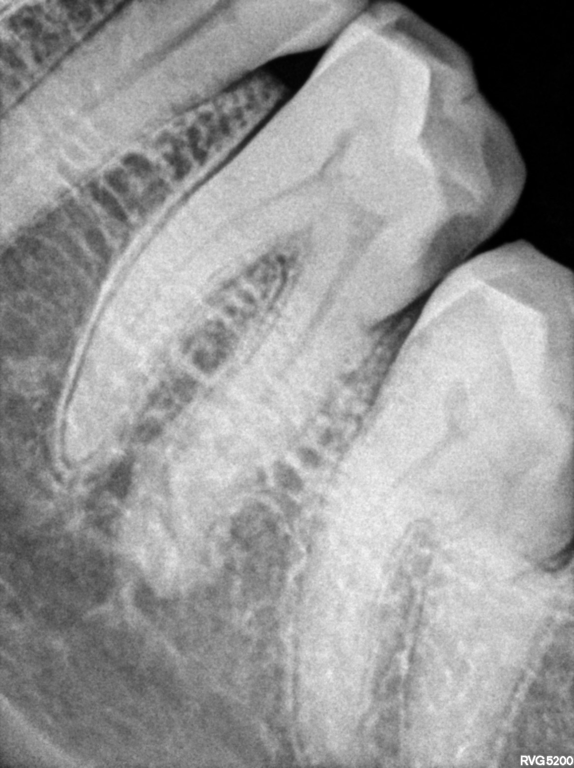 Dental X-ray